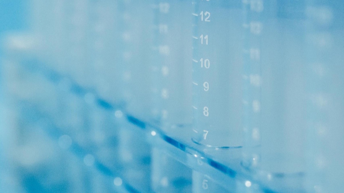 Laboratory test tubes in a rack — the science behind a DNA result